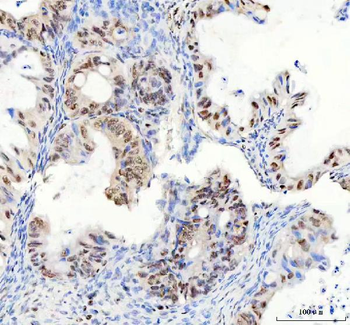 DDX1 Antibody (monoclonal, 3I10)