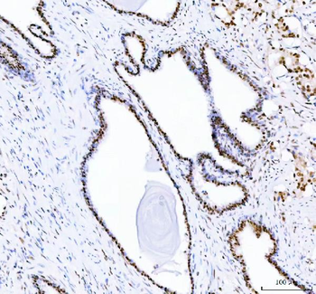 DDX1 Antibody (monoclonal, 3I10)