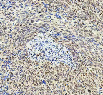 DDX1 Antibody (monoclonal, 3I10)