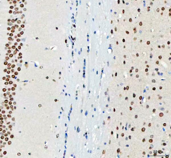 DDX1 Antibody (monoclonal, 3I10)