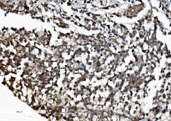 DDX1 Mouse Monoclonal Antibody