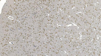 DDX1 Mouse Monoclonal Antibody