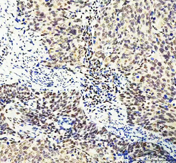DDX1 Antibody (monoclonal, 11E5)