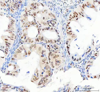 DDX1 Antibody (monoclonal, 11E5)
