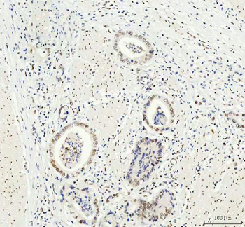 DDX1 Antibody (monoclonal, 11E5)