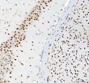 DDX1 Antibody (monoclonal, 11E5)