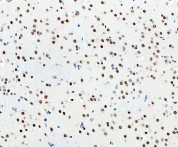 DDX1 Antibody (monoclonal, 11E5)
