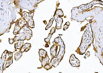 ADAMTS5 Rabbit Polyclonal Antibody
