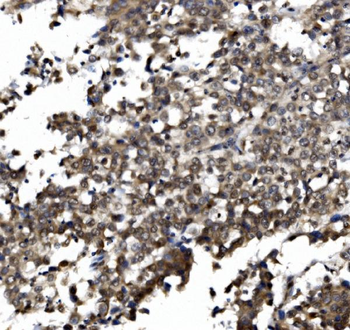 TORC1/CRTC1 Antibody