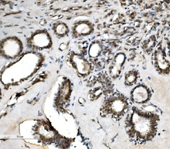 VPRBP/DCAF1 Antibody