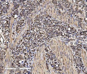 VPRBP/DCAF1 Antibody