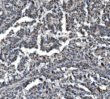 VPRBP/DCAF1 Antibody