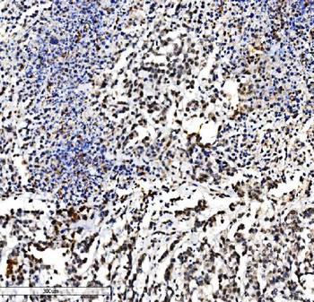 VPRBP/DCAF1 Antibody