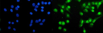 HAP1 Rabbit Polyclonal Antibody