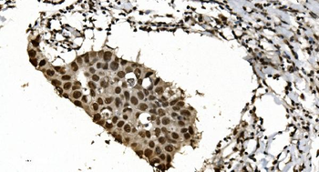 HNRNPH3 Antibody