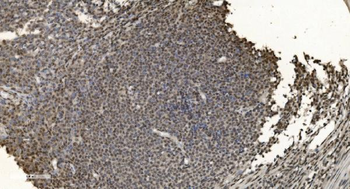 HNRNPH3 Antibody