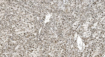 HNRNPH3 Antibody