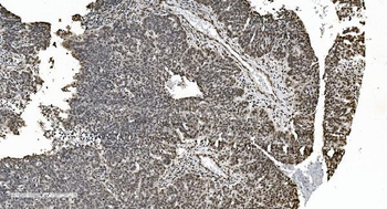 HNRNPH3 Antibody