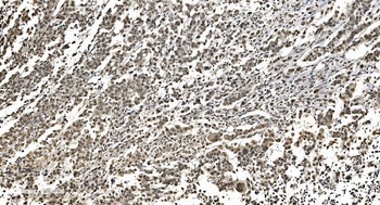 HNRNPH3 Antibody