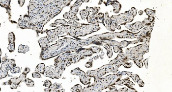 HNRNPH3 Antibody