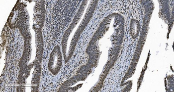 HNRNPH3 Antibody