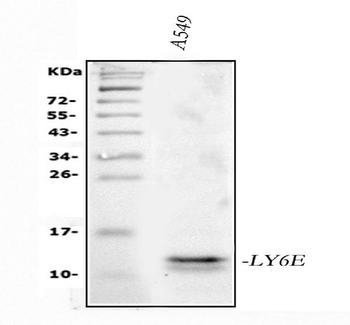 LY6E/SCA-2/SCA Rabbit Polyclonal Antibody