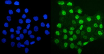 MCM4 Antibody