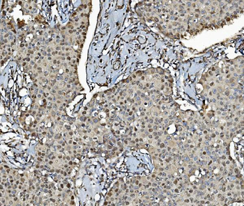 MCM4 Antibody