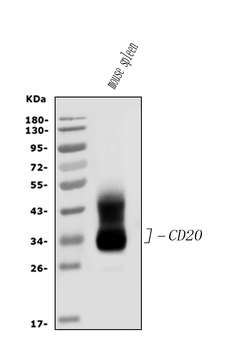 CD20/MS4A1 Antibody