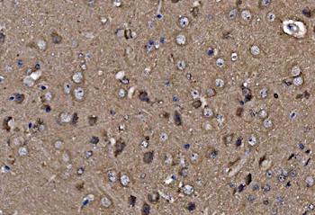 Profilin 2/PFN2 Antibody