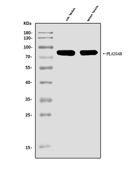 cPLA2 beta/PLA2G4B Antibody