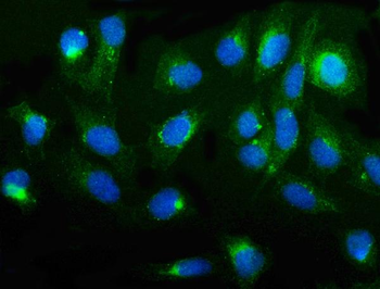 cGKI/PRKG1 Rabbit Polyclonal Antibody