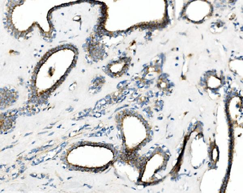 cGKI/PRKG1 Rabbit Polyclonal Antibody