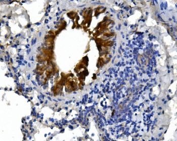 cGKI/PRKG1 Rabbit Polyclonal Antibody