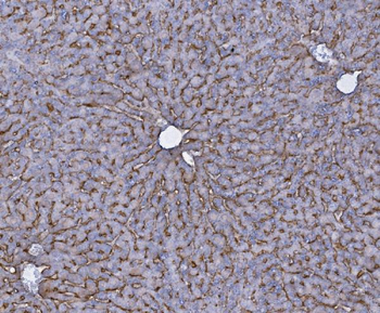 SLC10A1/NTCP1 Rabbit Polyclonal Antibody