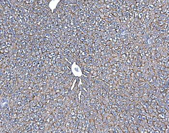 SLC10A1/NTCP1 Rabbit Polyclonal Antibody