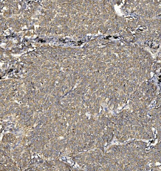 SV2A Antibody