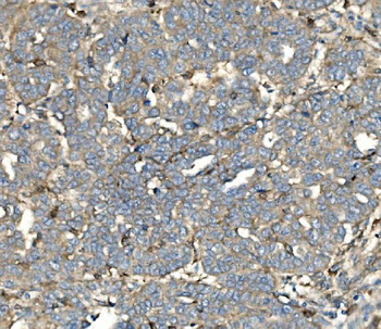 SV2A Antibody