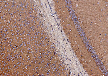 SV2A Antibody