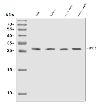 Uroplakin Ib/UPIb Rabbit Polyclonal Antibody