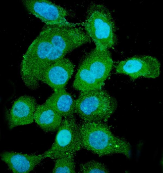 PNP Mouse Monoclonal Antibody
