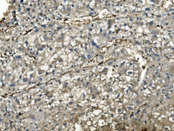 PNP Mouse Monoclonal Antibody