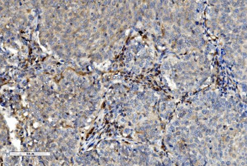 PNP Mouse Monoclonal Antibody