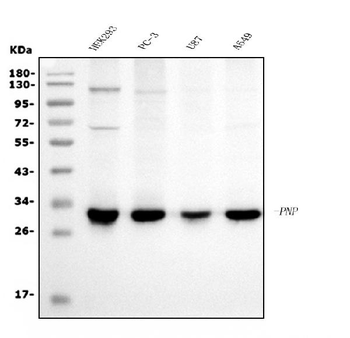 PNP Mouse Monoclonal Antibody