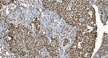 Ku70 Antibody (monoclonal, 9B6)