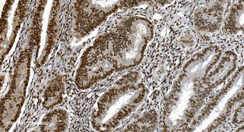 Ku70 Antibody (monoclonal, 9B6)