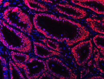 Ku70 Antibody (monoclonal, 3D7)