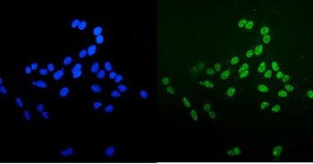 Ku70 Antibody (monoclonal, 3D7)