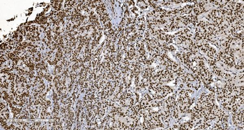 Ku70 Antibody (monoclonal, 3D7)