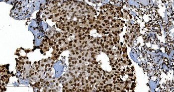 Ku70 Antibody (monoclonal, 3D7)